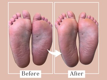 ベベ(Bebe)/20代女性/ガサガサお悩み