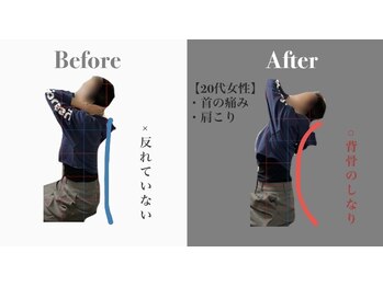リスタート腰痛整体院 舟入院/施術例：20代女性　首こり