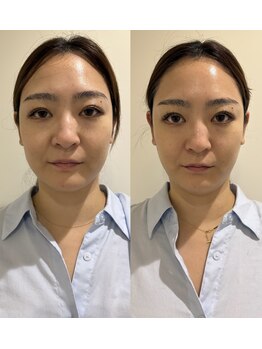 マホロバ(mahoroba)/ビフォーアフター