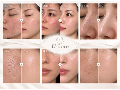 エクロール(E'clore)の写真