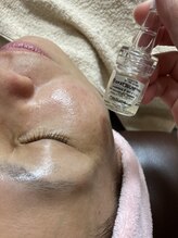 エステサロン オパール(OPALE)/高濃度美容液ボタリニウム