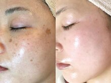 ファニービー 茨木店/Before→After