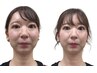 【最強の小顔へ】小顔縮小ハンド体験　￥3,980