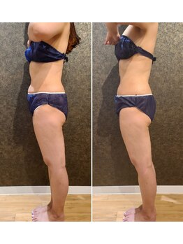 ワンルーム(1ROOM)/