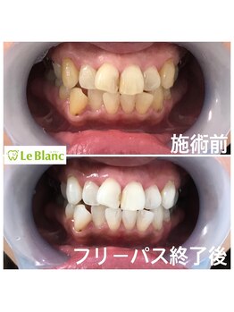 ルブラン 奈良店(Le Blanc)/本日フリーパス終了致しました