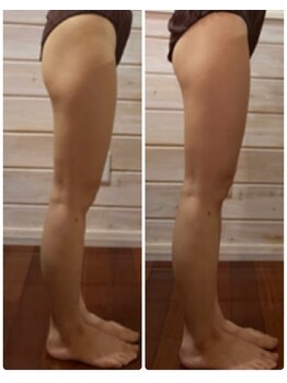 プリンセスモモ 佐世保白岳店(Princes Momo)/ビフォーアフター