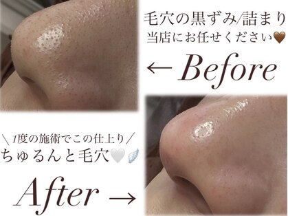 カピリナ(ka pilina)の写真