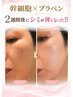 幹細胞×プラズマ美容 回数券をお持ちの方