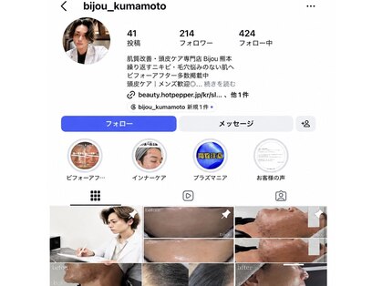 ビジュー(Bijou)の写真