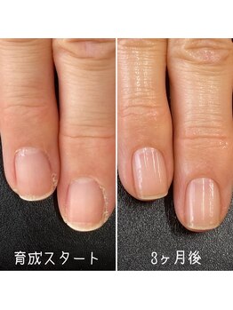 ネイルズ アヴァンティ(Nails Avanti)/最強のネイルケア3ヶ月コース