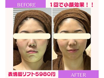 ユーフォリア(Euphoria)