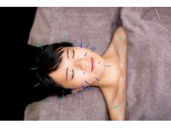 東麻布アマン(東麻布Aman)/美容鍼灸　step3 顔頭首鍼