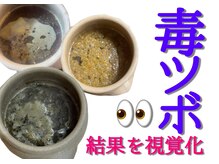 むん