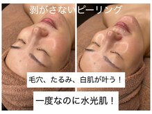 ラウラウ(laulau)