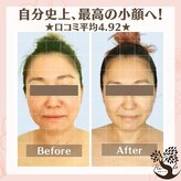 フェイシャルコルギ ヒロ(Hilo)