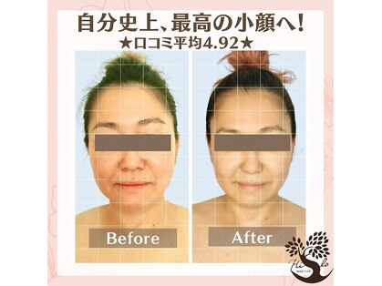 フェイシャルコルギ ヒロ(Hilo)の写真