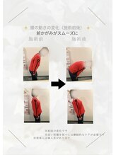nのレシピ みんなの整体院/腰痛/前かがみの動きの変化