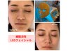 肌悩みに合わせる【オーダーメイド美肌ケア】