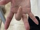結愛(ゆうあ)の写真/50代の手指の痛みや痺れの腱(スジ)を専門的に整えて痛みを改善する腱引き療法の整体屋です