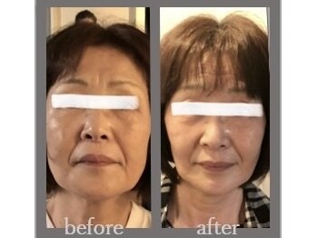 ナルエステティック(NARU.esthetic)の写真/表面的なケアで満足できない方へ。骨格から整える独自メソッドで、内側から輝く理想の美肌を叶えます◎