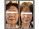 ナルエステティック(NARU.esthetic)の写真/表面的なケアで満足できない方へ。骨格から整える独自メソッドで、内側から輝く理想の美肌を叶えます◎