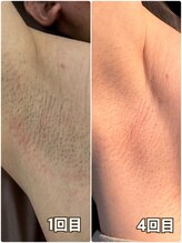 メンズ シンバ(SIMBA)/☆ ビフォーアフター ☆