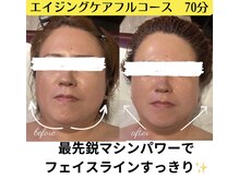 ドクターヴィー 高知(DrVi)/最新機器で輪郭にもアプローチ