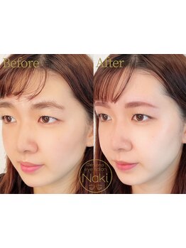 アイブロウメニューがあるサロン