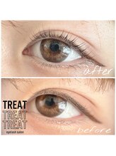 トリート(TREAT)/まつげパーマ、ラッシュリフト