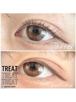 トリート(TREAT)/まつげパーマ、ラッシュリフト