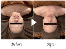 サロン ド プレシャス(Salon de Precious)/小顔整体マッサージ/もみほぐし