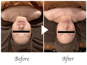 サロン ド プレシャス(Salon de Precious)/小顔整体マッサージ/もみほぐし