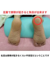 ナカザワ(NAKAZAWA)/膝の痛みと魚の目の関係・2