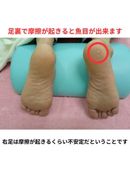 ナカザワ(NAKAZAWA)/膝の痛みと魚の目の関係・2