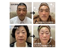 エヌフェイシャル(N.facial)の雰囲気（お客様は肌悩みの20代～エイジングケアの80代までと幅広いです）