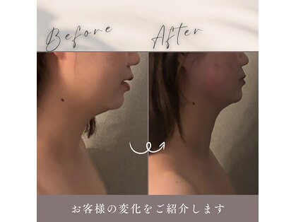 ハチハチ(808)の写真