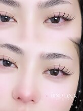 シュシュ(chouchou)/バインドロック80束