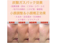 太陽と月の雰囲気（毛穴レス&炭酸ガスパック&小顔調整&全身リンパ/深い癒しと美肌へ）