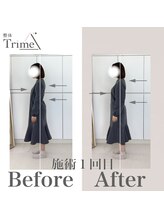トライム(Trime)/姿勢B/A【歪み姿勢改善】