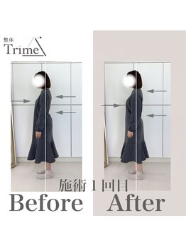 トライム(Trime)/姿勢B/A【歪み姿勢改善】