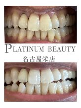 プラチナムビューティー 名古屋栄本店(PLATINUM BEAUTY)/お客様Before After
