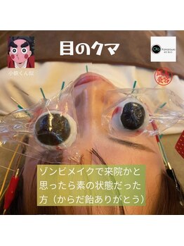 オラカナザワ(Ola Kanazawa)/目のお悩み