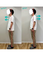 整体院 モンテ(monte)/肩こり