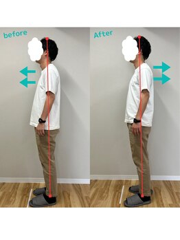 整体院 モンテ(monte)/肩こり