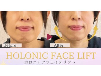 フィーカ/曖昧フェイスラインが変化!