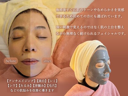 フェルル 梅田北新地店(Feruru)の写真