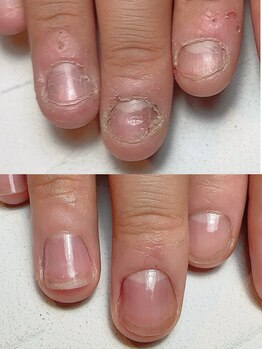 スマイルニコ(smile nico)/