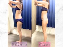 パラディ(PARADIS)/ハイパーナイフ/シェイプ/コルギ