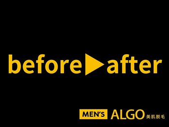 アルゴ 敦賀店(ALGO)/メンズビフォーアフターご紹介♪