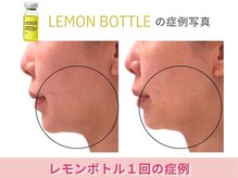 アメリイ 百合ヶ丘 新百合ヶ丘(Amerii)/【40代レモンボトル】1回の結果